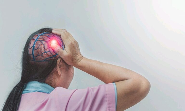 AVC sévère ou mortel : 3 facteurs de risque révélés par une nouvelle étude